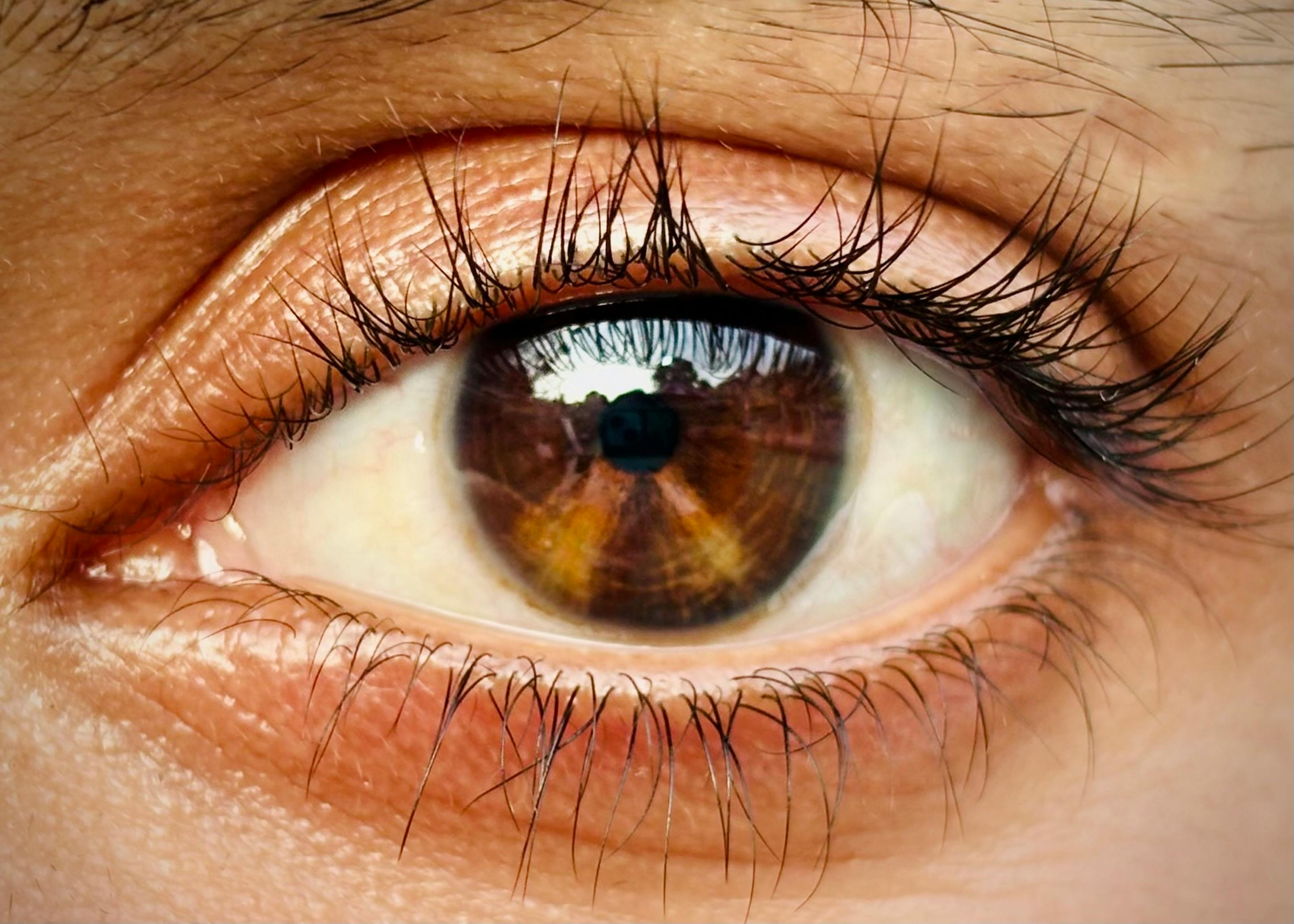 A close-up of someone's eye | Source: Pexels