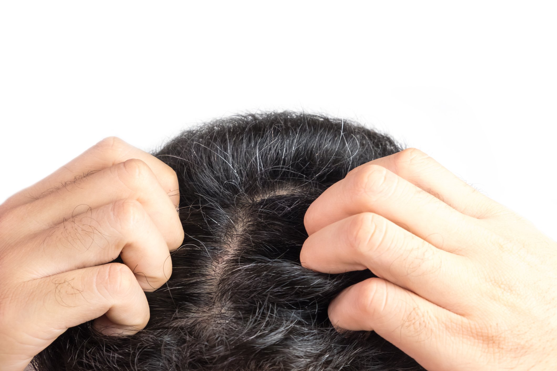Une femme qui se gratte les cheveux. | Photo : Getty Images