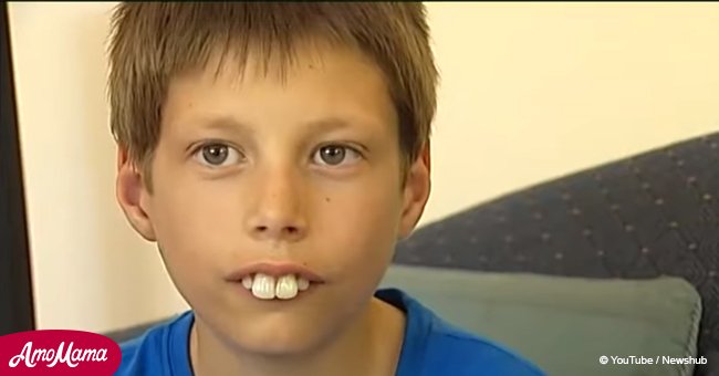 Chico burlado por sus compañeros debido a sus dientes, finalmente recibe una nueva sonrisa