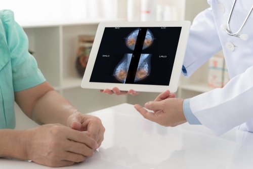 Signes de cancer du sein l Source : Pixabay Signes de cancer du sein l Source : Pixabay