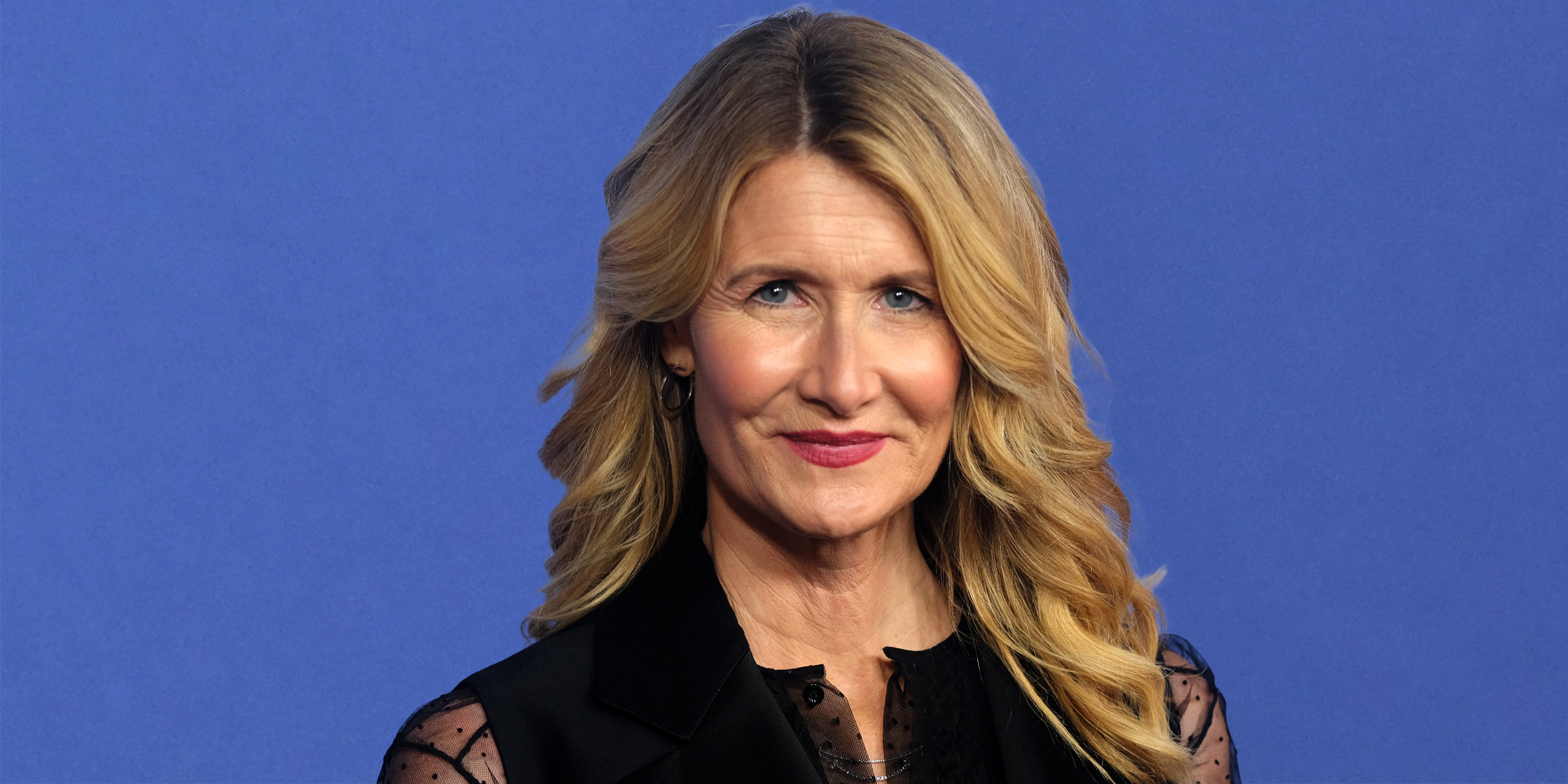 How Does Laura Dern's Curly-Haired Son, Who Underwent Surgery After ...