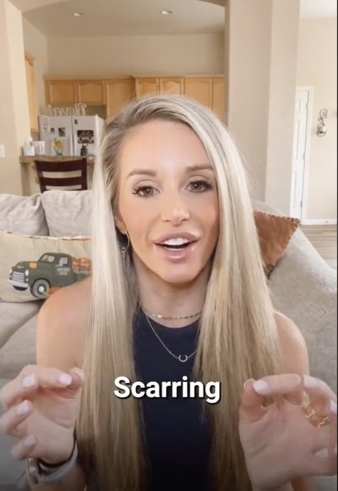 TikToker Casey Costa describing her bridesmaid experience as "scarring" | Source: tiktok/four.nine