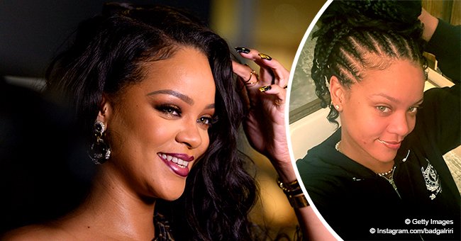 Rihanna Reveals Pimple as She Shares Her First Unedited Selfie of 2020