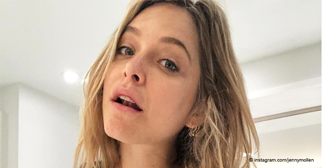 Jenny Mollen Admits She Dropped Her Son on His Head Causing Him to ‘Fracture His Skull’