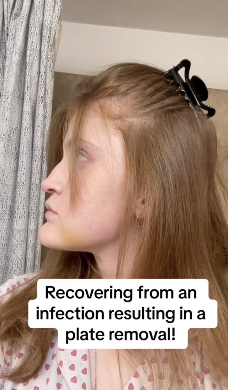 Virginia Elder sits in profile, her expression neutral as discoloration fades. | Source: TikTok/virginiaeelder