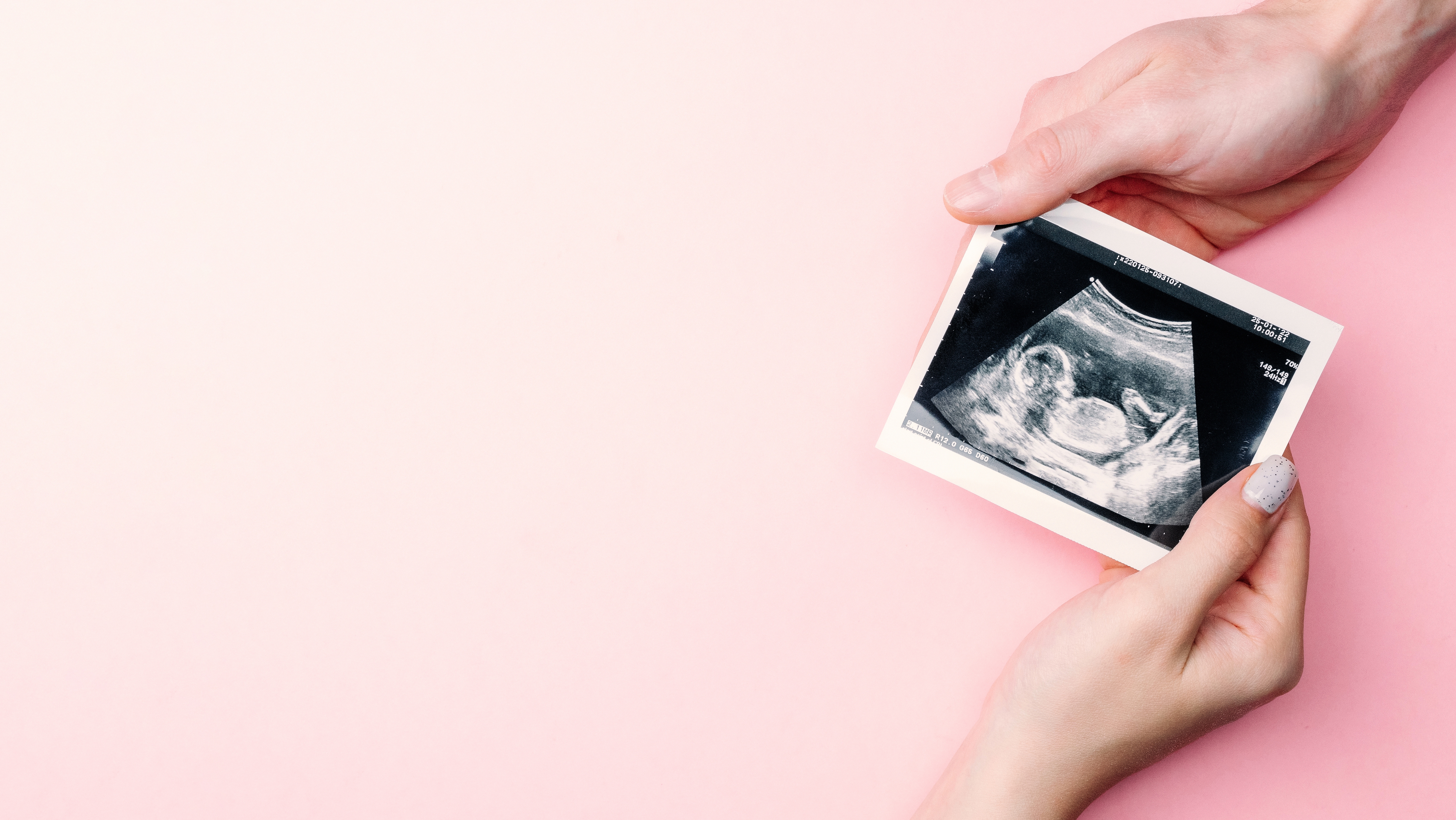 A couple holding an ultrasound scan | Source: Shutterstock