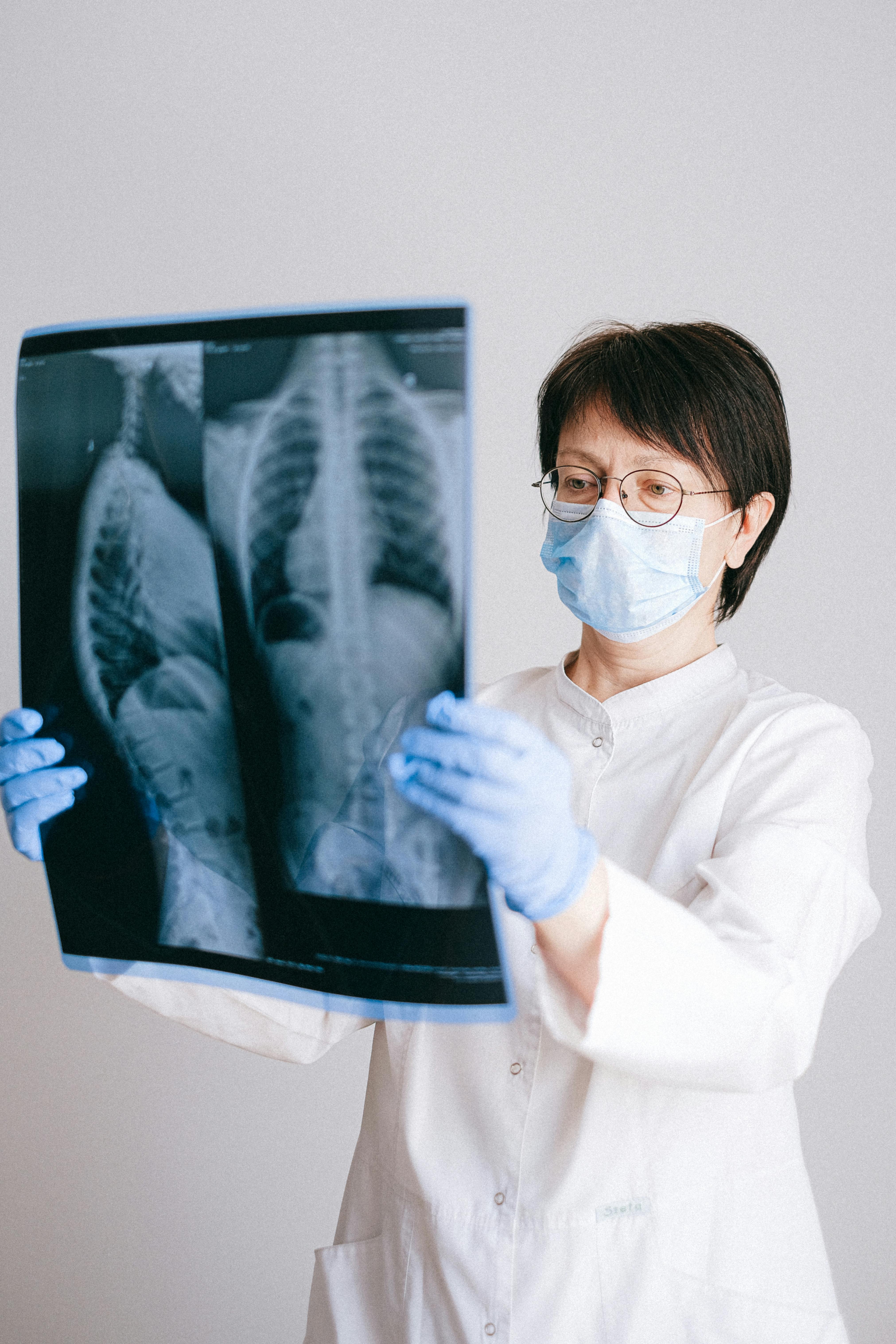 A medical professional looking at an x-ray of lungs | Source: Pexels