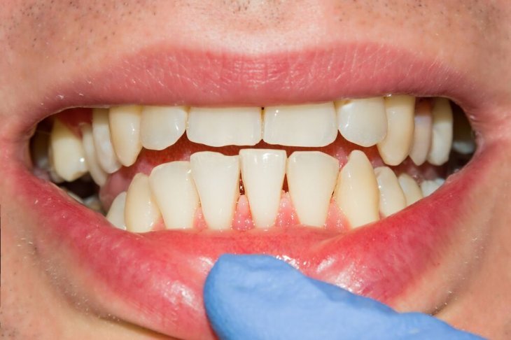 Imagen tomada de: Shutterstock Imagen tomada de: Shutterstock