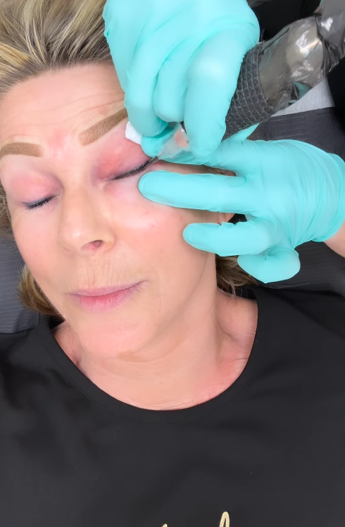Ruth Langsford having her eyeline tattoo done | Source: Instagram/ruthlangsford