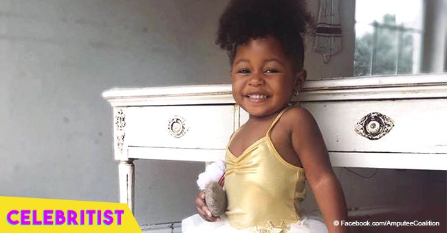 The story of the little girl who proudly rocks her prosthetic leg still melts hearts