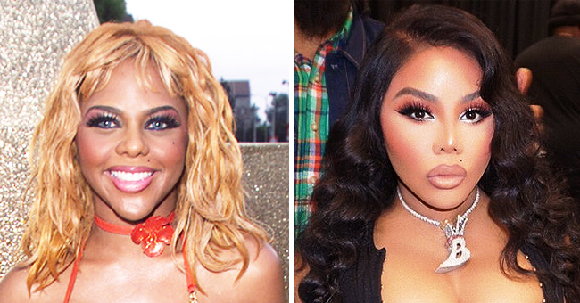 What Lil' Kim May Have Done to Her Face, According to Plastic Surgeons