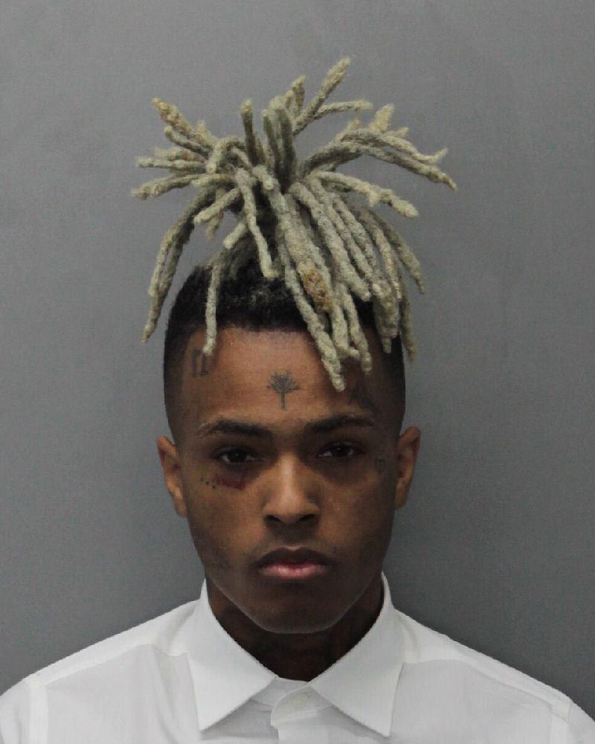 XXXTentacion poses for his mugshot on December 15, 2017, in Miami, Florida. | Source: Getty Images