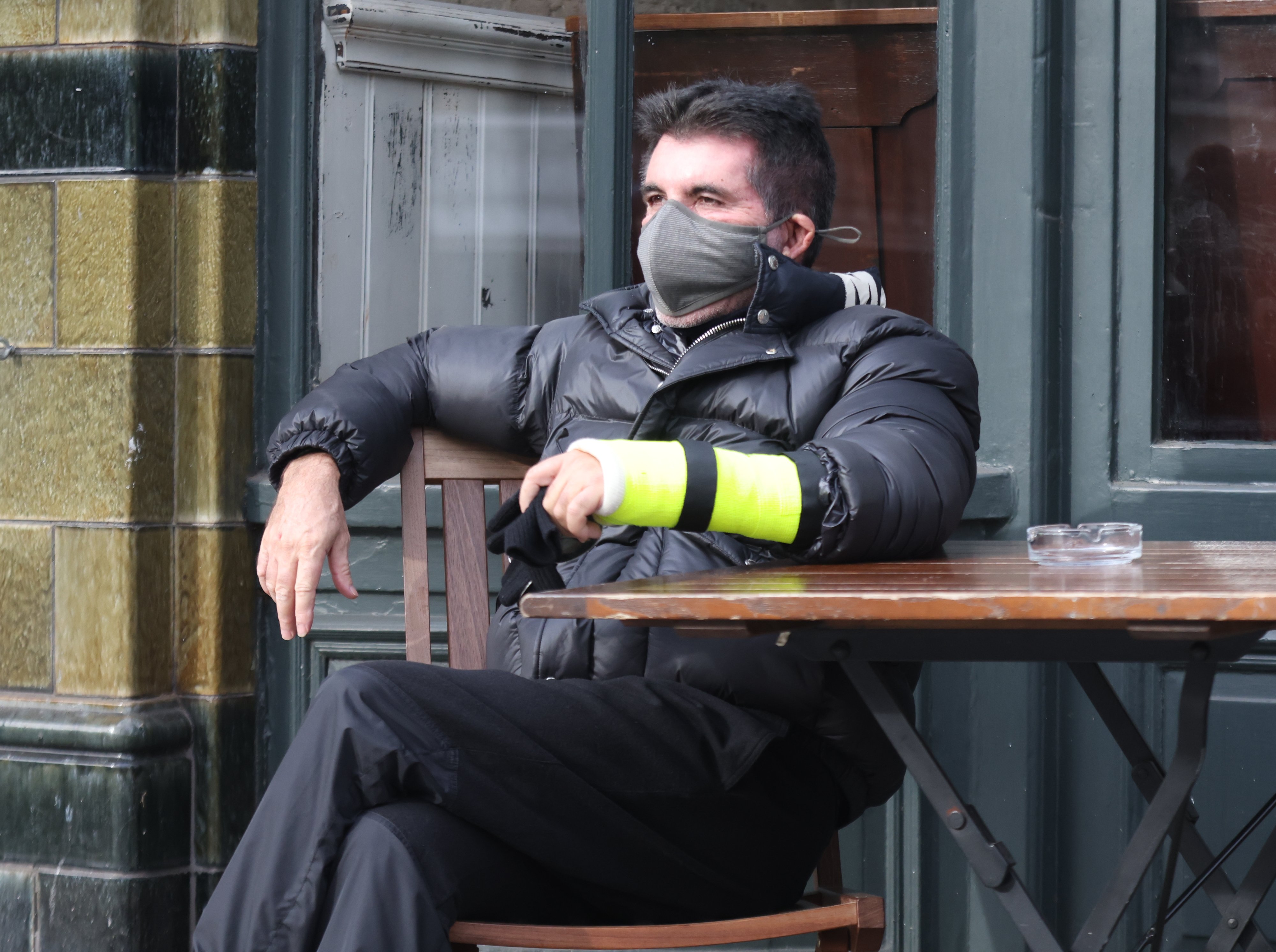 Simon Cowell shows the broken arm he suffered in a bicycle accident last week as he sits outside The Castle pub in Holland Park wearing his cast on February 2, 2022, in London. | Source: Getty Images
