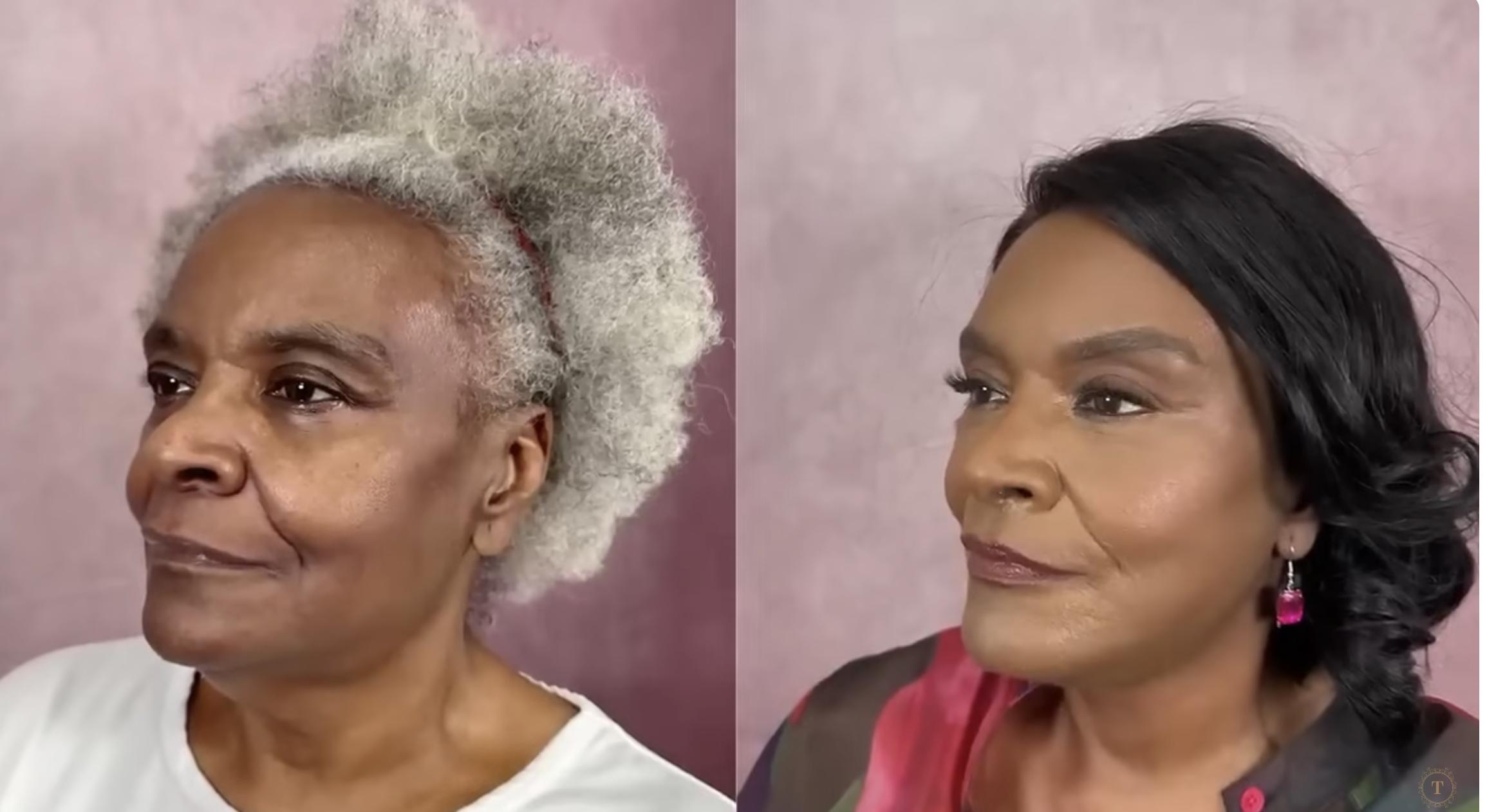 Linda Truesdale before and after surgery dated February 27, 2025 | Source: YouTube/@Dr.Truesdale