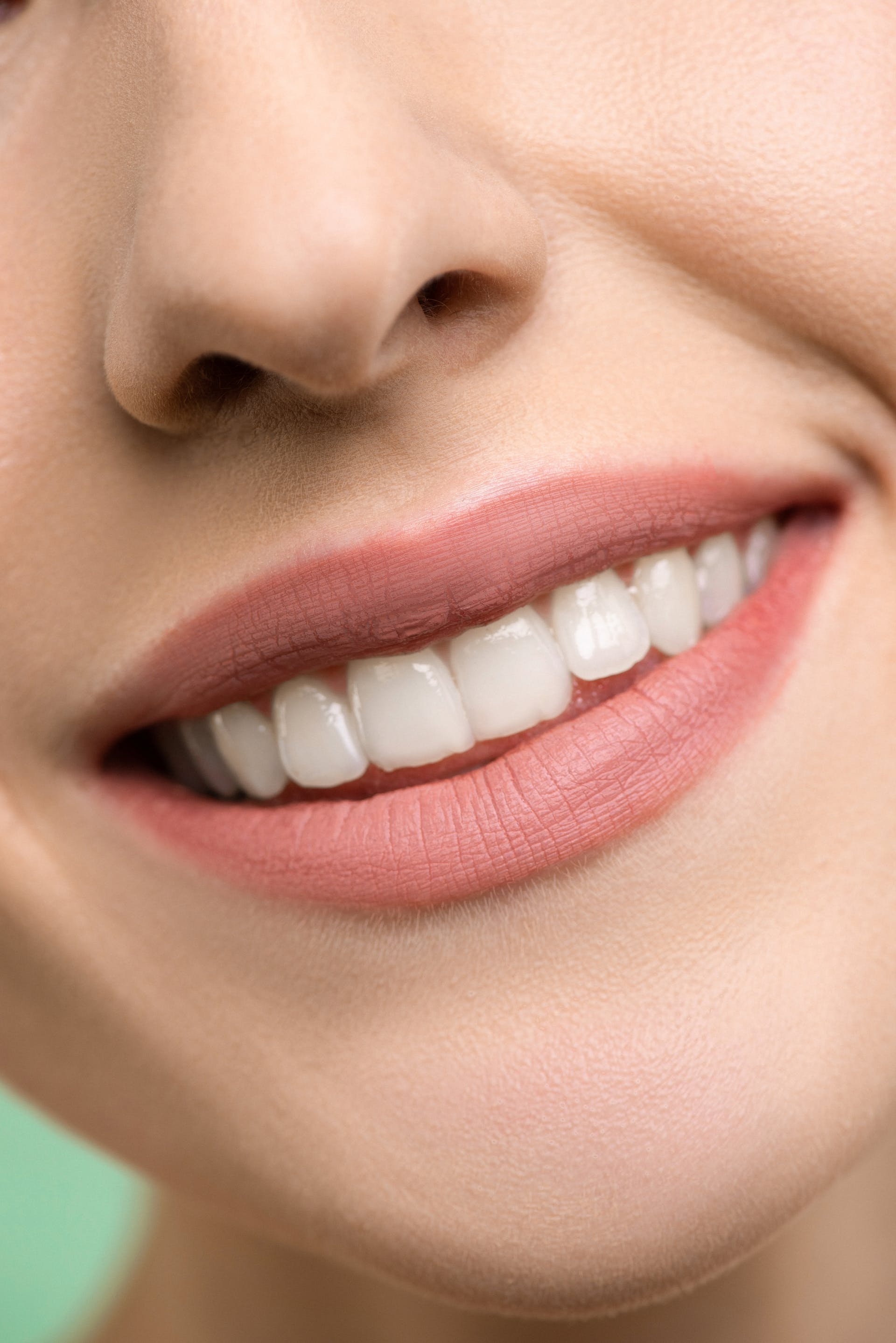 Close-up of a woman's smile | Source: Pexels