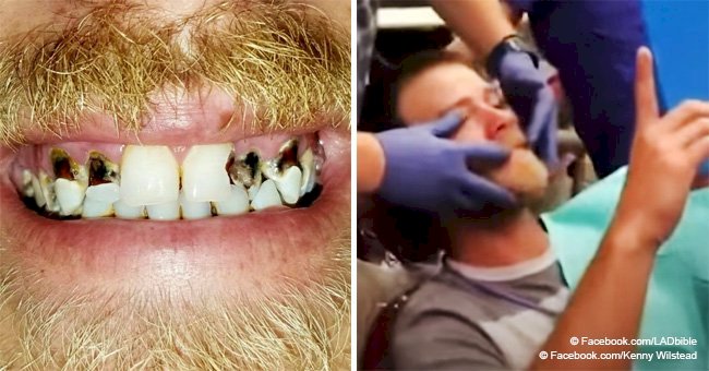 Dentist gives embarrassed man his smile back after countless years of insecurity