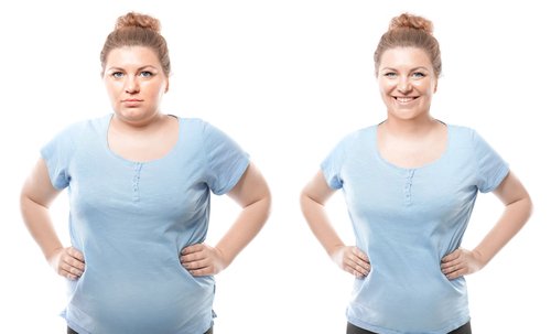 Une femme en surpoids | Photo : Shutterstock