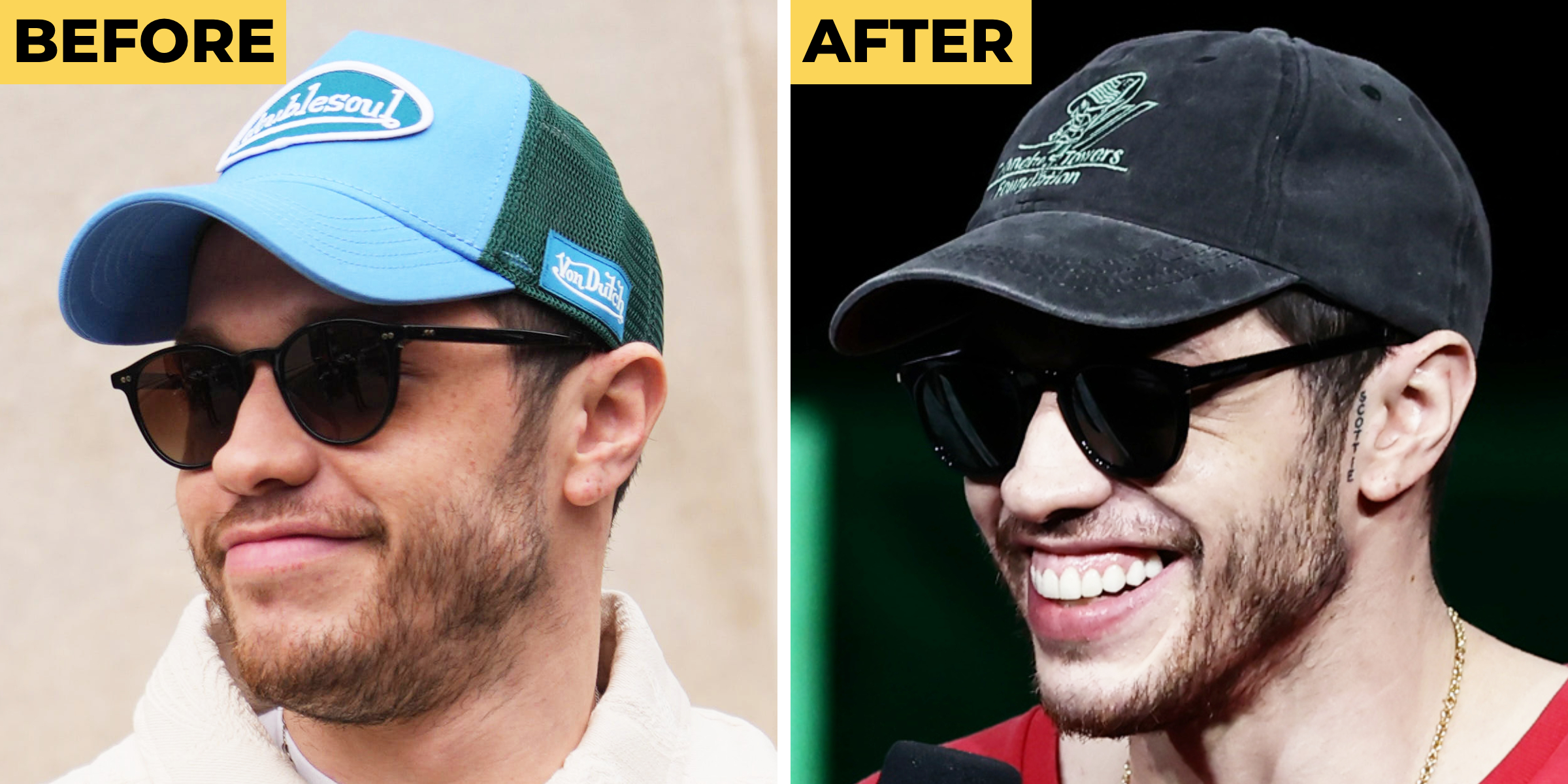 Pete Davidson seen outside Cult Gaia, during New York Fashion Week, on February 15, 2025 | Pete Davidson speaks onstage during the Amazon MGM Studios CinemaCon 2026 Presentation | Source: Getty Images