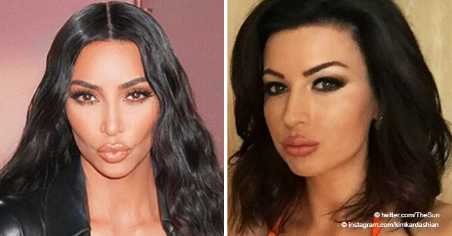 Mom Who Wanted to Look like Kim Kardashian Ended up with Lips 'Gone Right up to Her Nose'