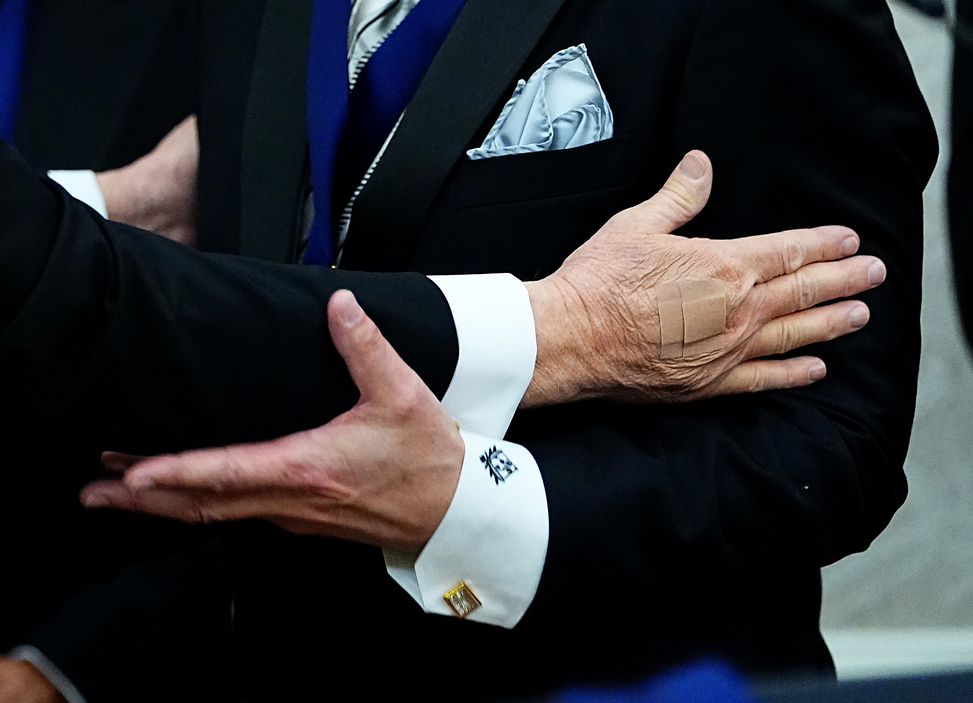 A close-up of Donald Trump's bandaged hand during the medal presentation ceremony for the Kennedy Center Honorees in the Oval Office of the White House in Washington, D.C., on December 6, 2025. | Source: Getty Images
