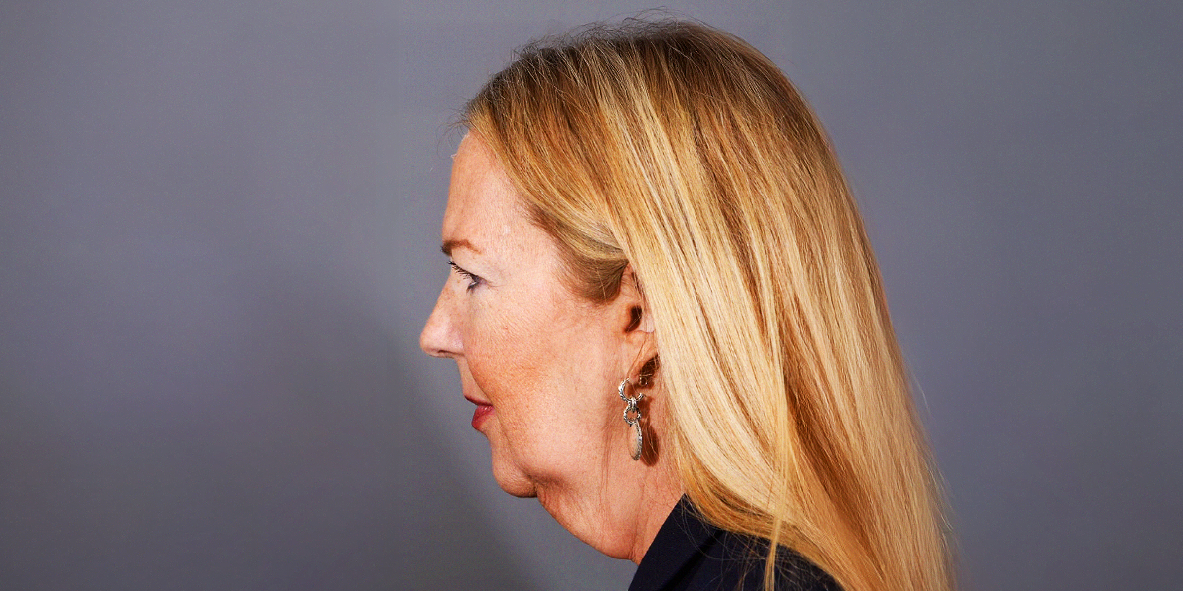 Woman before plastic surgery | Source: TikTok/@quatela_center