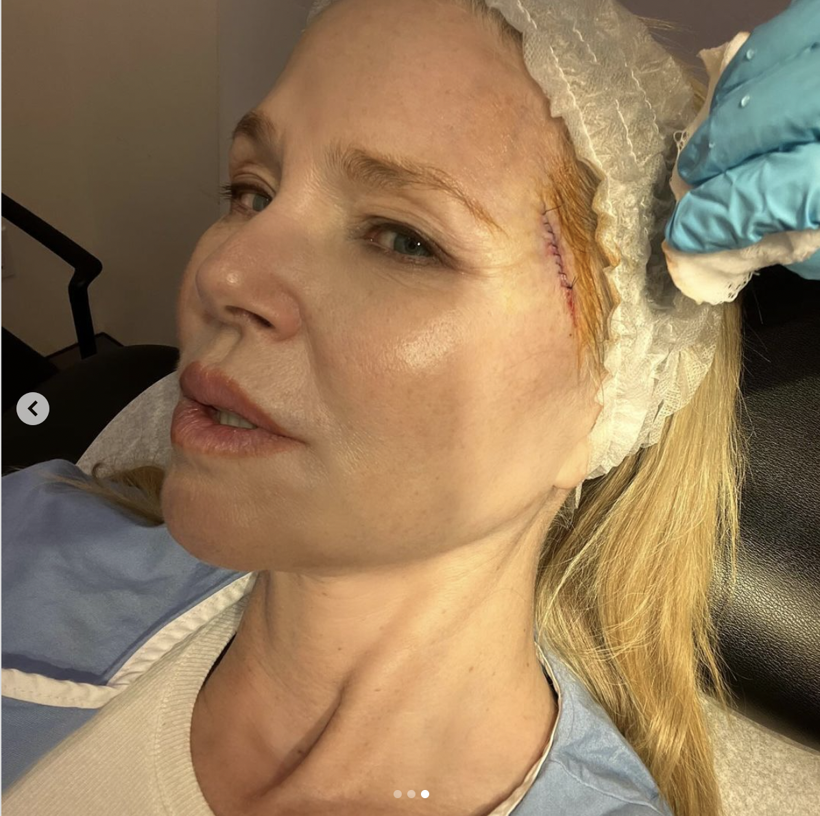 Christie Brinkley after her procedure, dated March 2024 | Source: Instagram/ChristieBrinkley