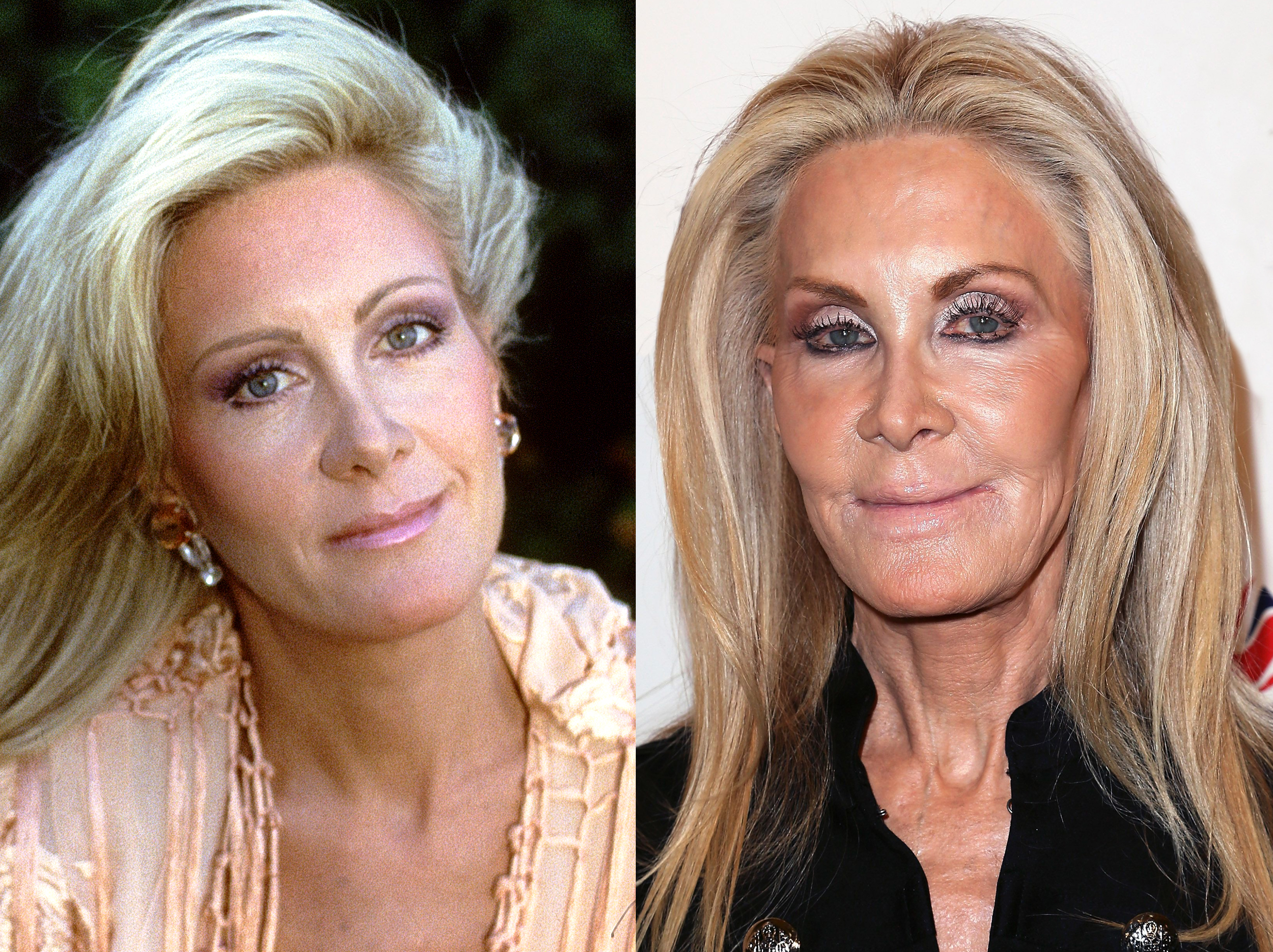 Joan Van Ark, 1985 | Joan Van Ark, 2016 | Source: Getty Images