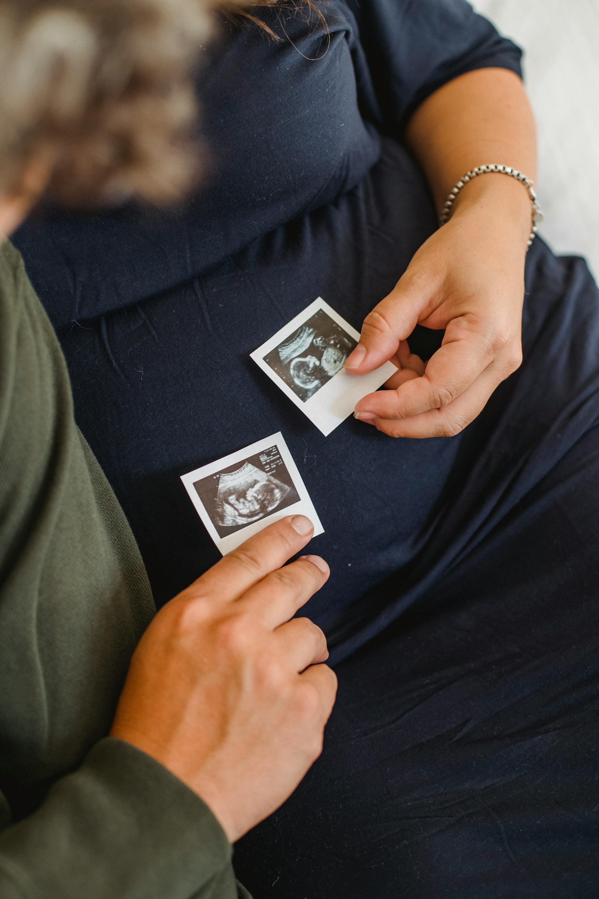 A couple holding two sonograms | Source: Pexels