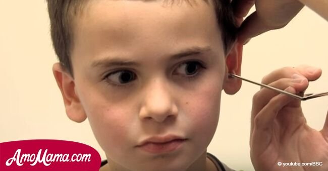 Boy thought he had a pencil stuck in his ear. But doctor makes an unpleasant discovery