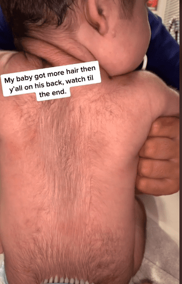 Photo of a baby with a hairy back | Photo: TikTok / blshelby