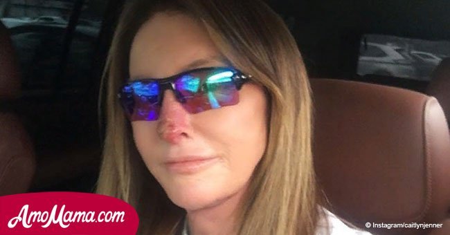 Caitlyn Jenner, 68, gives update on her nose after recent photos of her face surfaced
