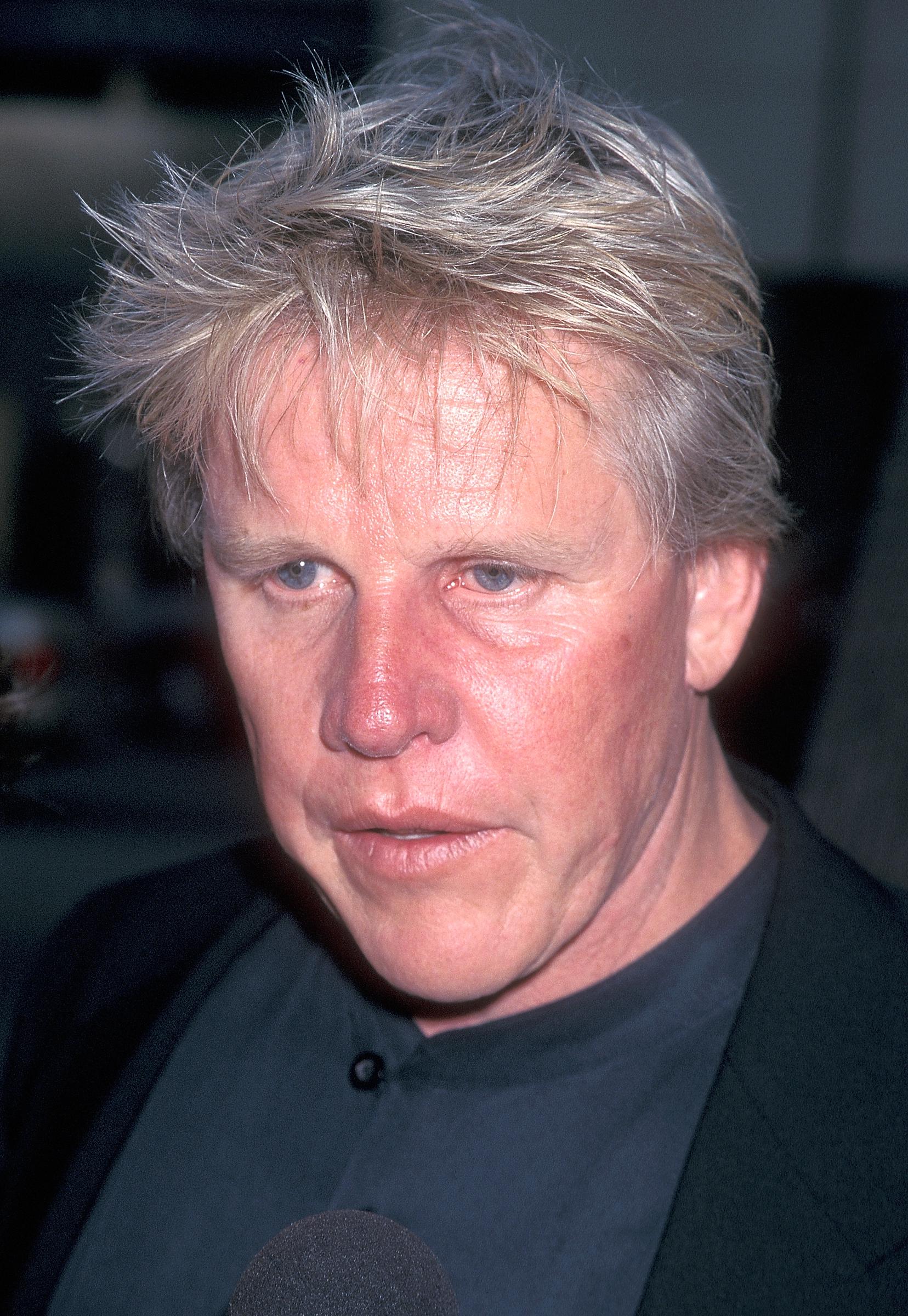 The disease resulted in a facial procedure which ultimately changed Gary Busey's physical appearance. | Source: Getty Images