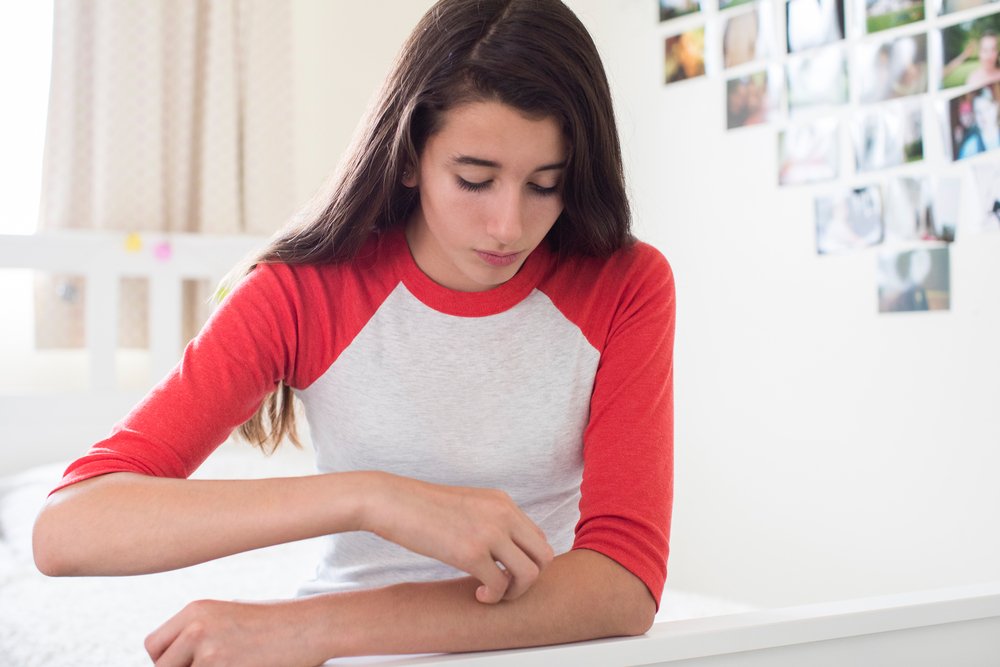 Joven con comezón en el brazo. Fuente: Shutterstock