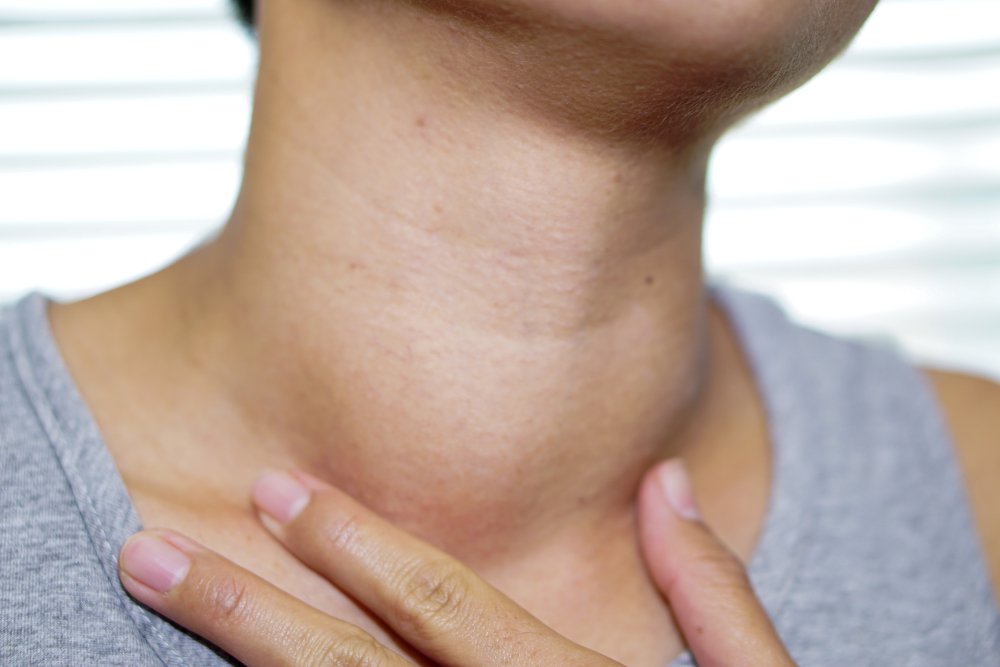 Mujer con bulto sospechoso en el cuello. Fuente: Shutterstock