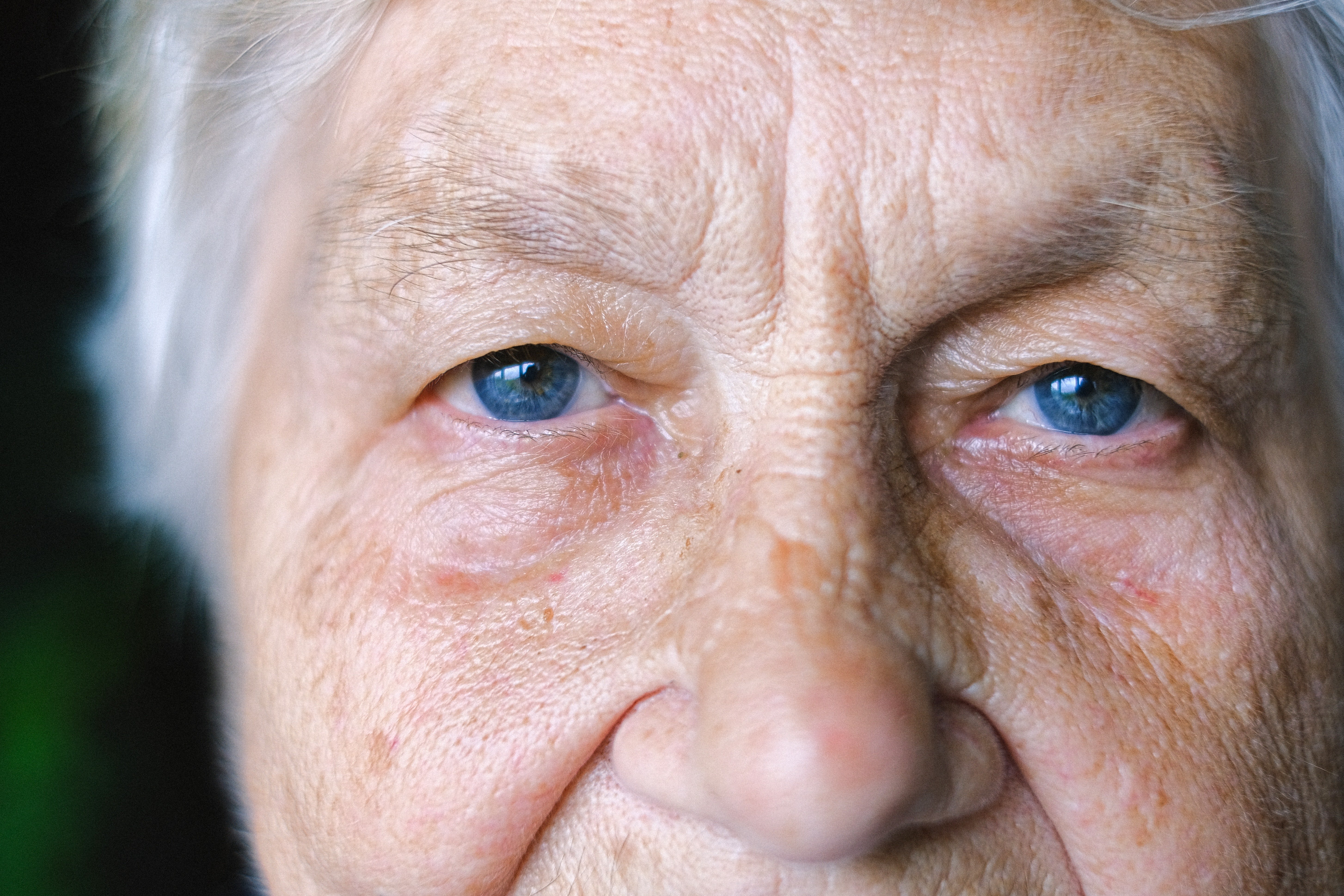 Rostro de una anciana. | Foto: Pexels