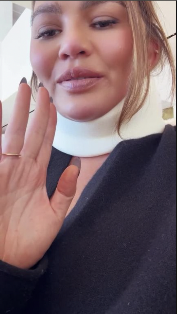 Chrissy Teigen shows her neck brace in an Instagram story, dated May 2024 | Source: Instagram/ChrissyTeigen