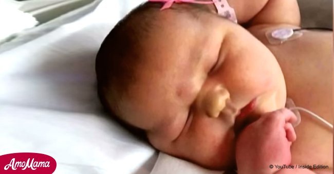 Mother was surprised when newborn baby came out as big as a toddler