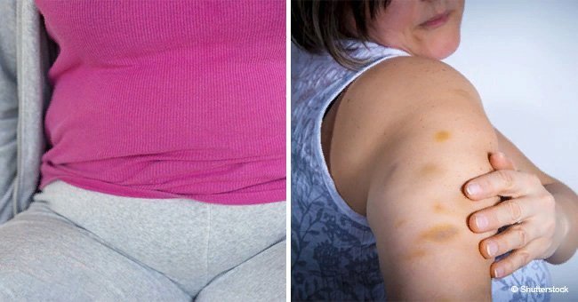 Most women usually ignore these 15 symptoms, but they are signs of cancer