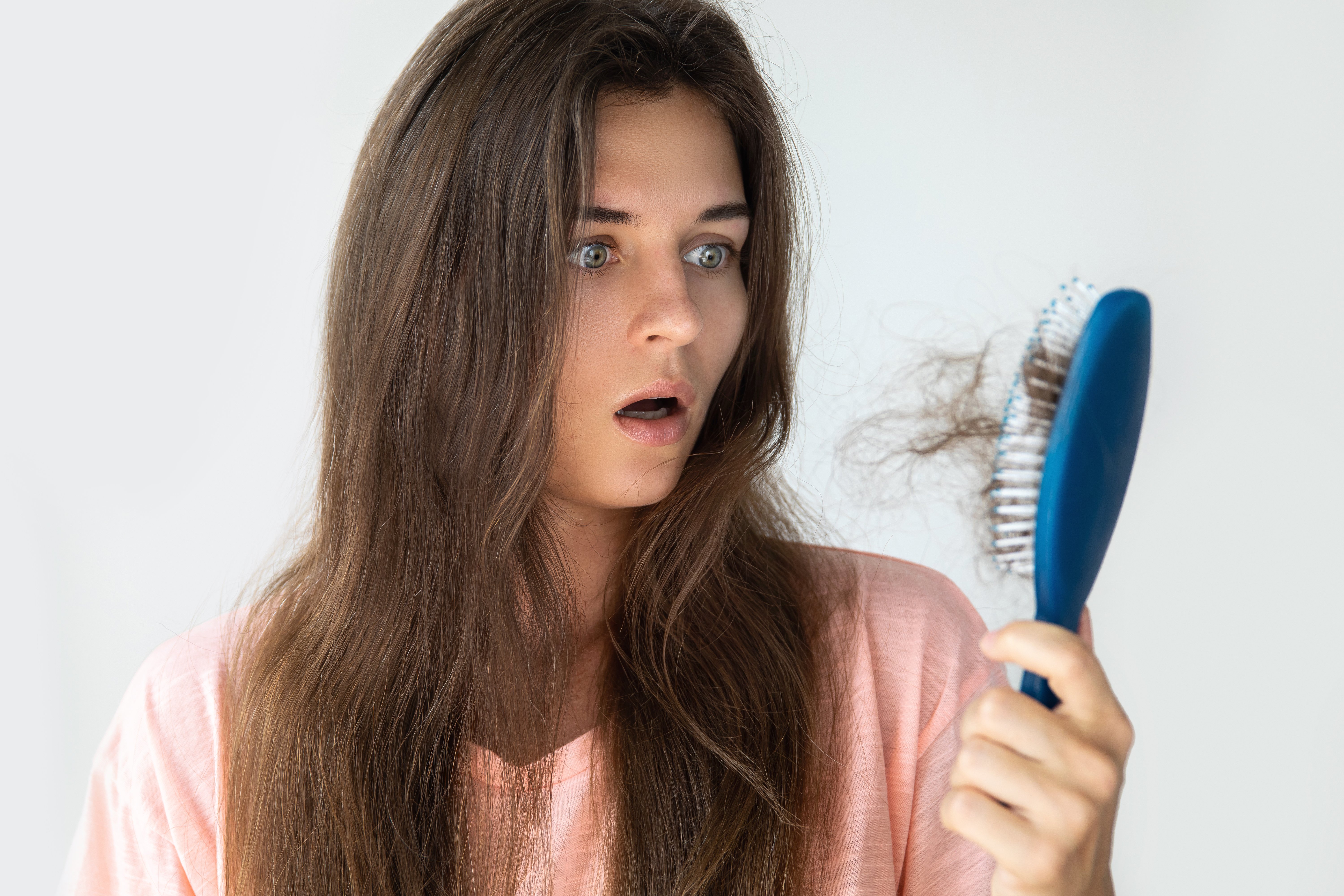 Une jeune femme très contrariée à cause de la perte de cheveux. | Photo : Shutterstock