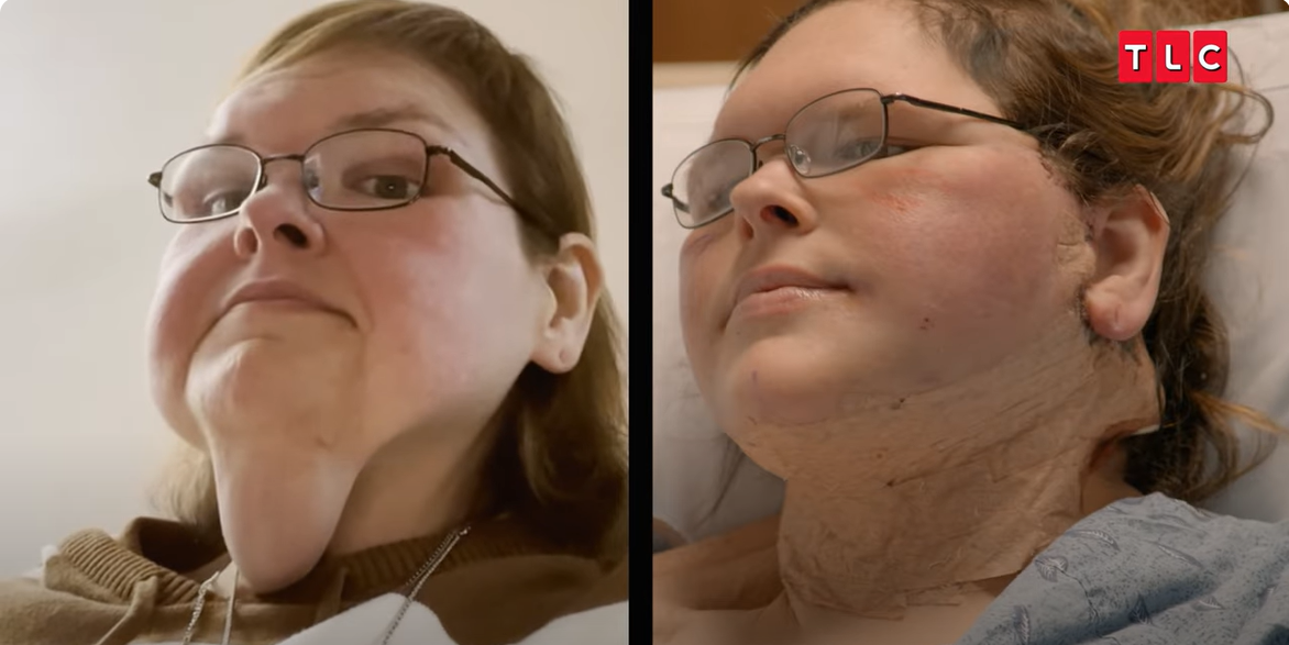 A photo showing Tammy Slaton before and after her surgery, from a video post dated June 6, 2025 | Source: YouTube/TLC