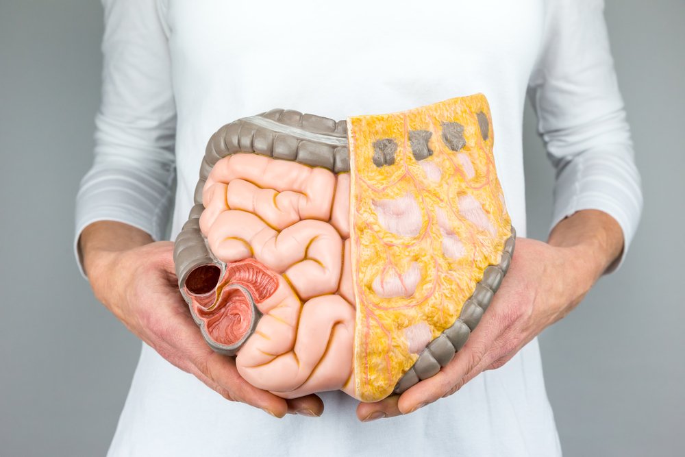 Mujer sostiene modelo de los intestinos. Fuente: Shutterstock