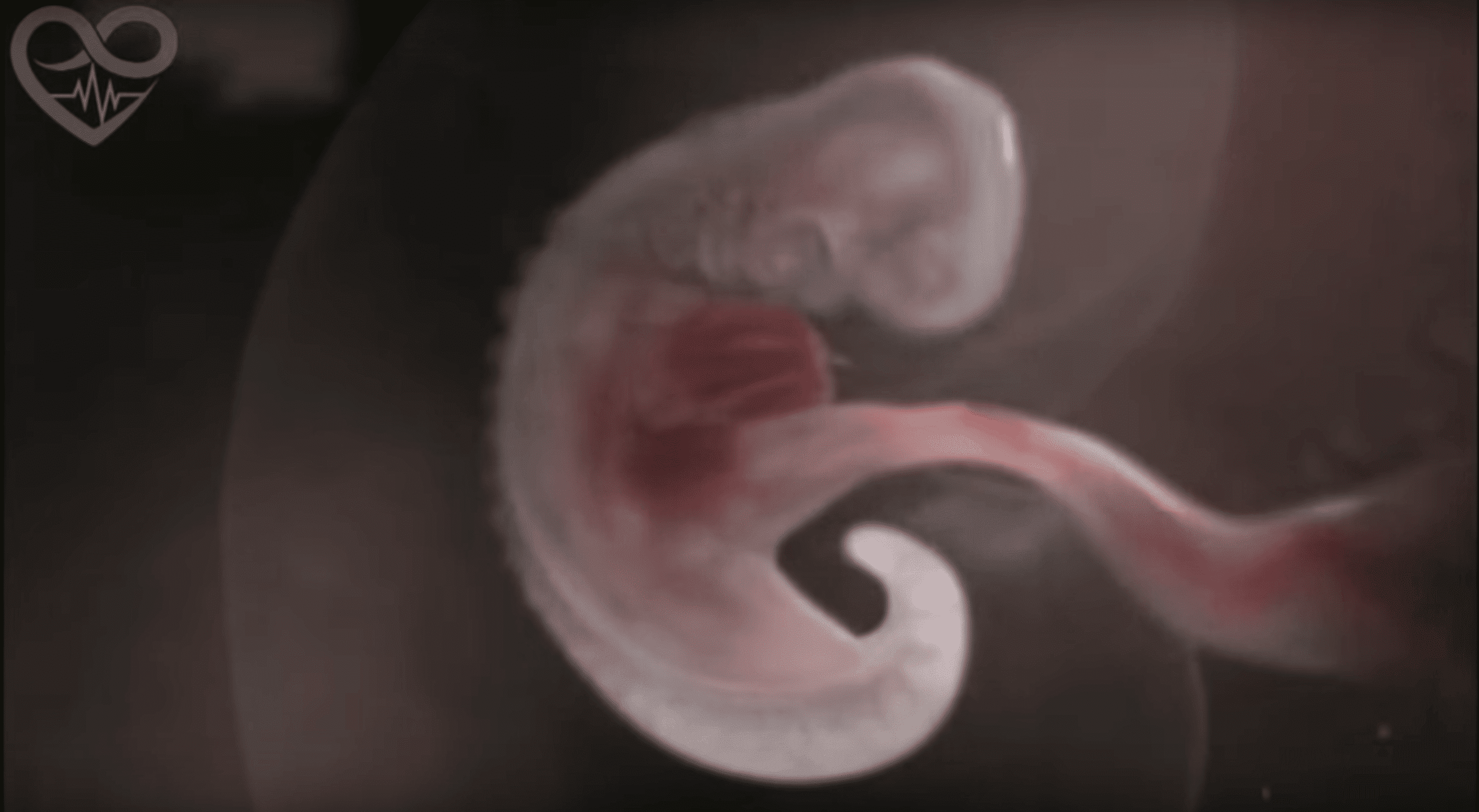 Fetus develops heart and spine. | Source: YouTube/BobbyandDannaJackson