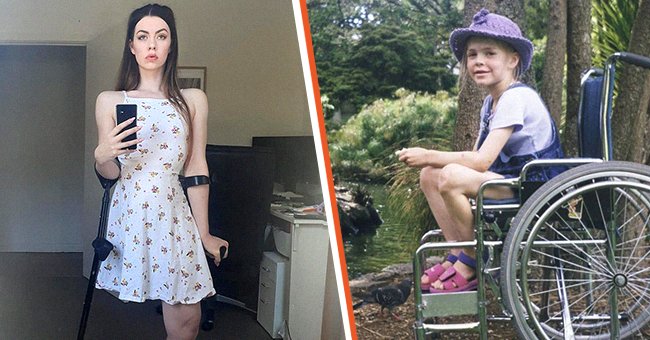 Trolls accuse amputee model of photoshopping off her leg