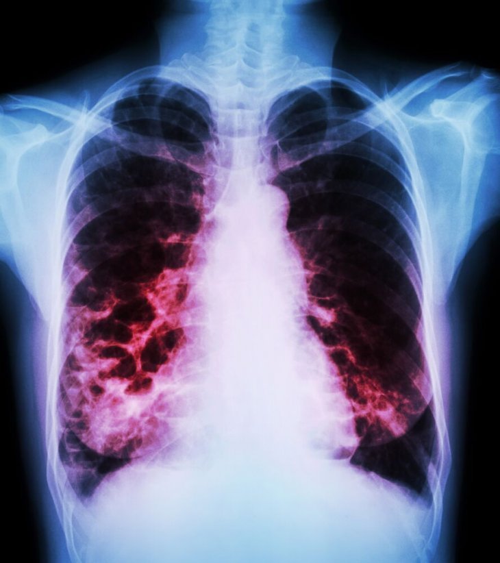 Imagen tomada de: Shutterstock Imagen tomada de: Shutterstock