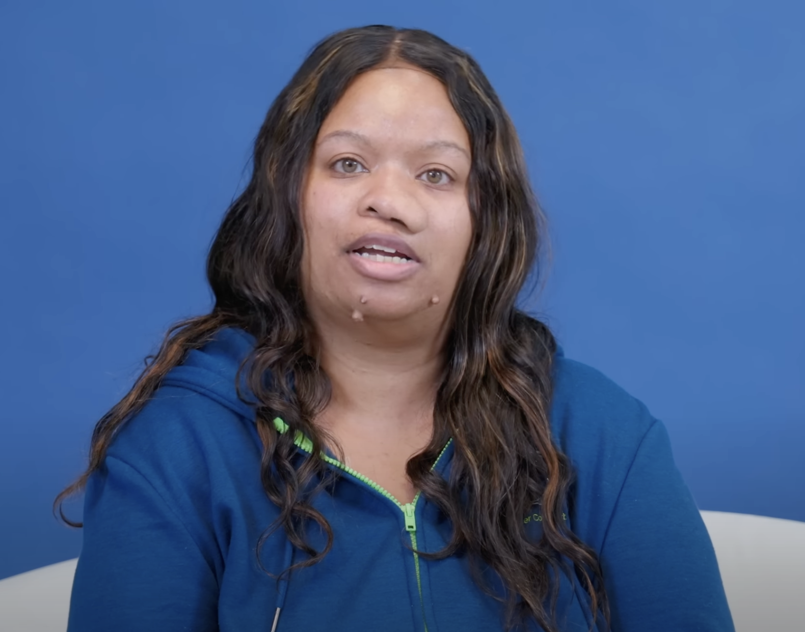 Danielle tumor-ridden face before surgery as seen in a video dated August 2, 2024 | Source: YouTube/@Dr.Truesdale