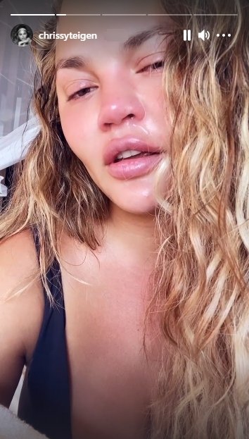 Chrissy Teigen's emotional post-therapy face | Photo: Instagram/chrissyteigen