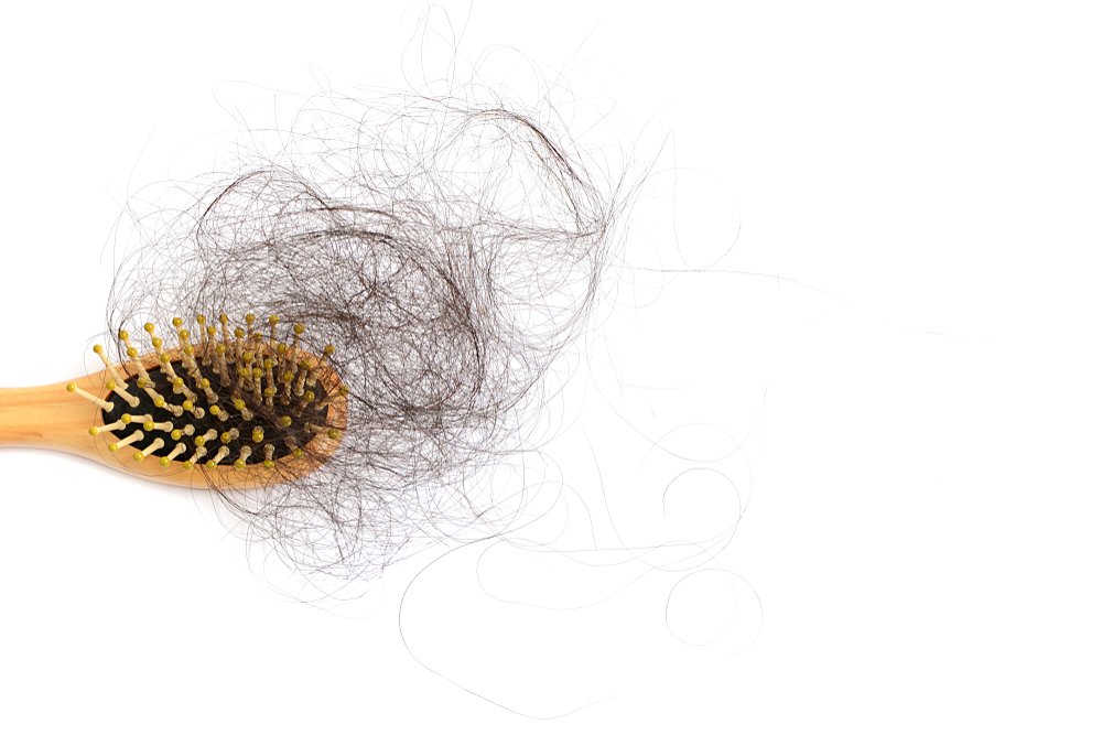 Des cheveux sur un peigne. | Photo : Shutterstock