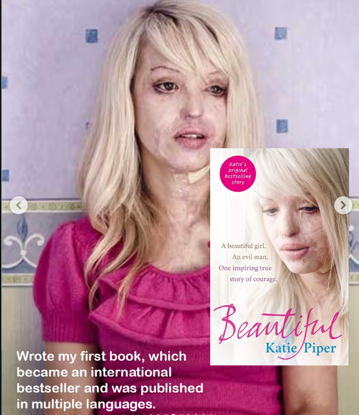 Katie Piper's book "Beautiful" | Source: Instagram/KatiePiper