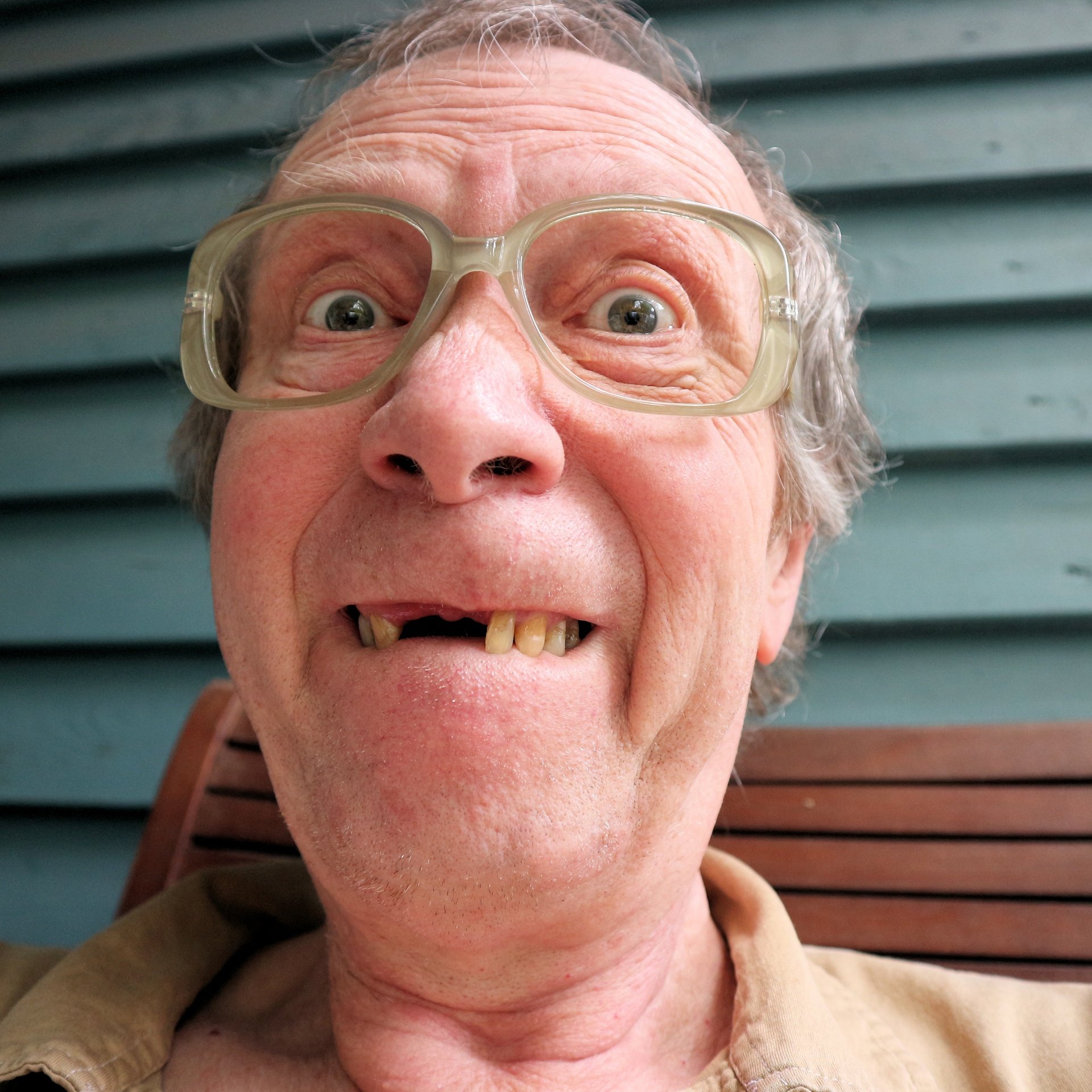 Hombre mayor con ausencia de dos dientes frontales. | Imagen: Needpix.com