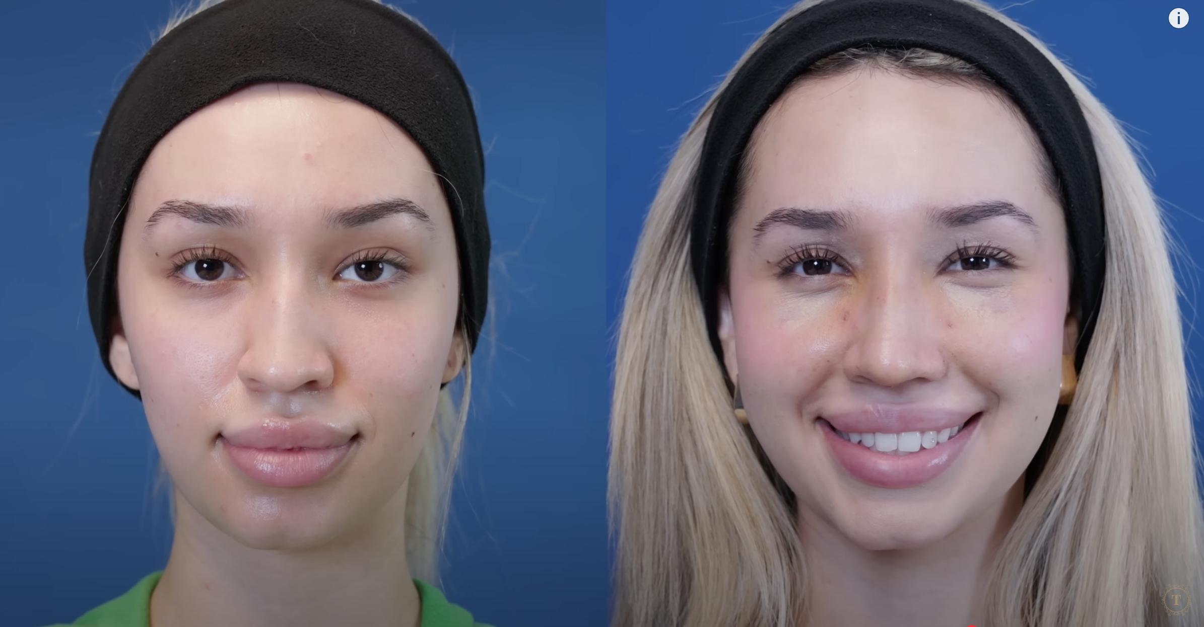 Ivana before and after surgery, dated July 26, 2024 | Source: YouTube/@Dr.Truesdale